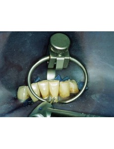 Cervical Clamp 214