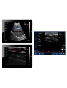 VIATOM DUAL HEAD LINEAR/CONVEX WIRELESS PORTABLE ULTRASOUND available July 2023
