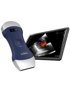 VIATOM DUAL HEAD LINEAR/CONVEX WIRELESS PORTABLE ULTRASOUND available July 2023